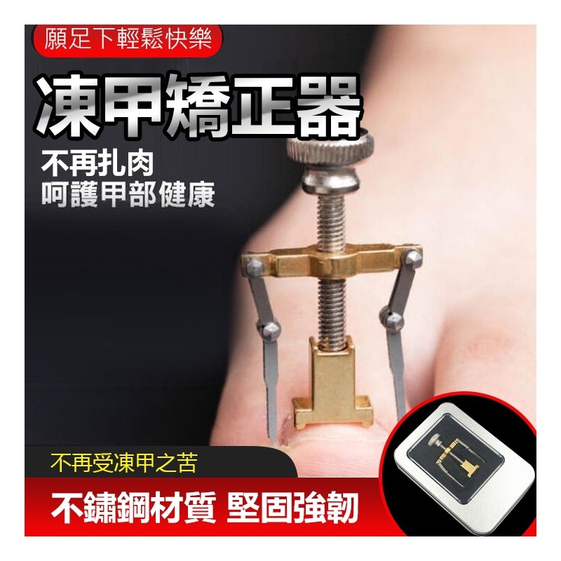 【B-193】不鏽鋼凍甲矯正器 美甲腳趾卷甲 嵌甲矯正器 甲溝炎 糾正指甲 矯正器 指甲內陷糾正器 指甲矯正器" 8入/組 (紅利51000點)